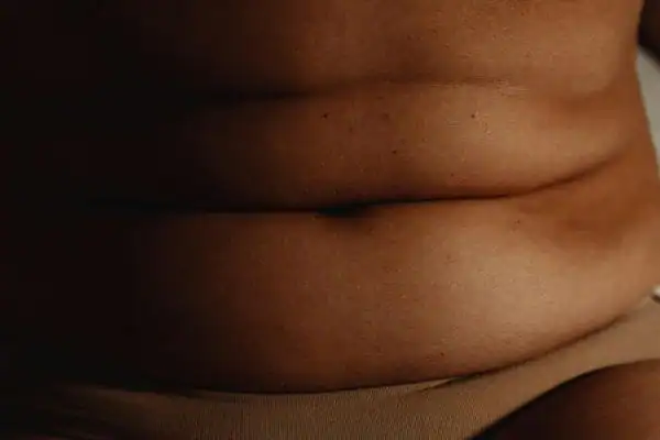 The Hidden Connection: How Stress Shapes Your Fitness and Body Composition 3 image of what stress can do on the stomach area and how Lipo 360 Colchester can help to change your body shape.
